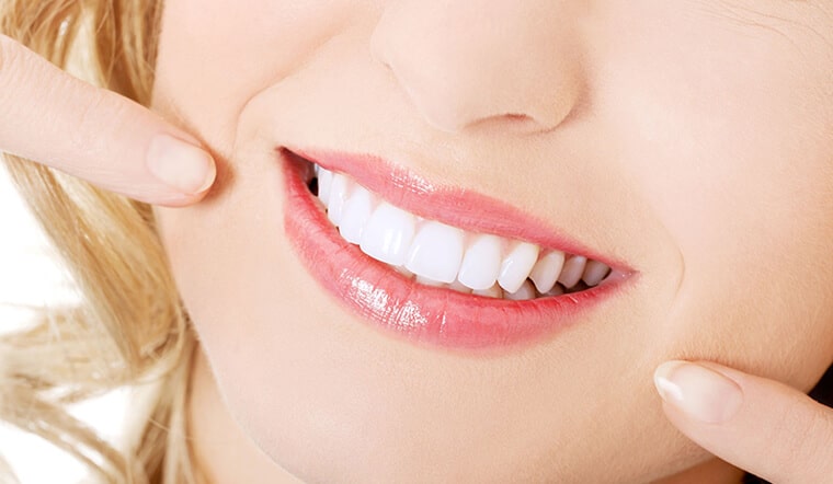 Tẩy trắng răng bằng công nghệ Brilliant Smile