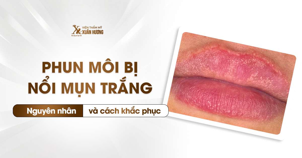 phun môi bị nổi mụn trắng