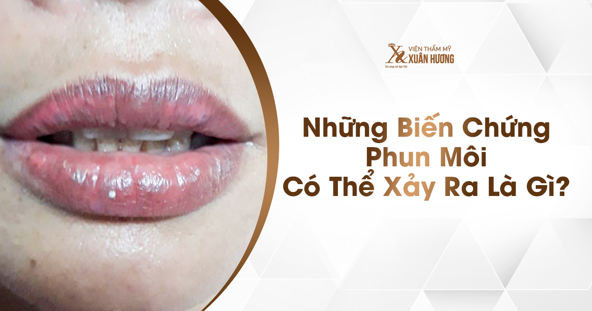 biến chứng sau phun môi