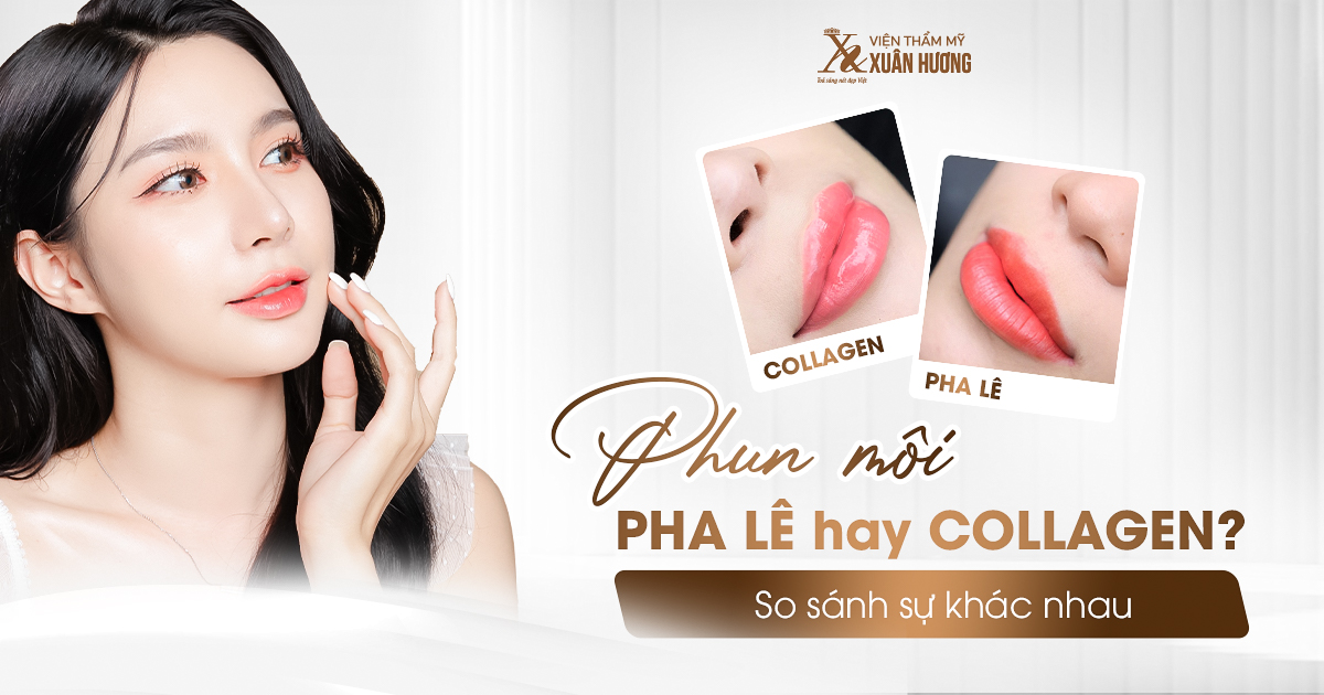 nên phun môi pha lê hay collagen