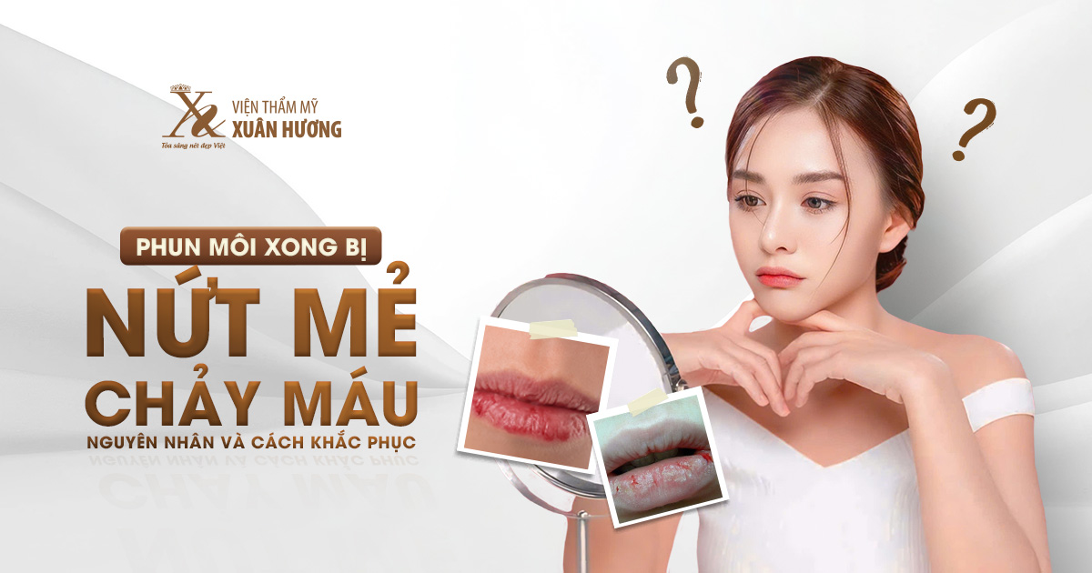 phun môi xong bị nứt nẻ chảy máu