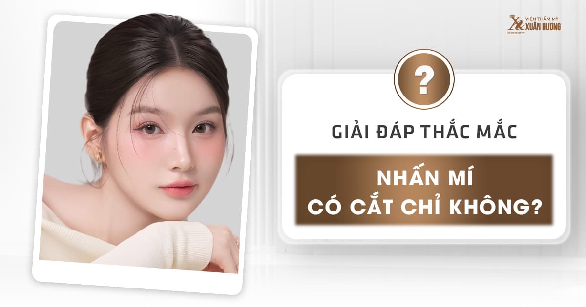 nhấn mí có cắt chỉ không