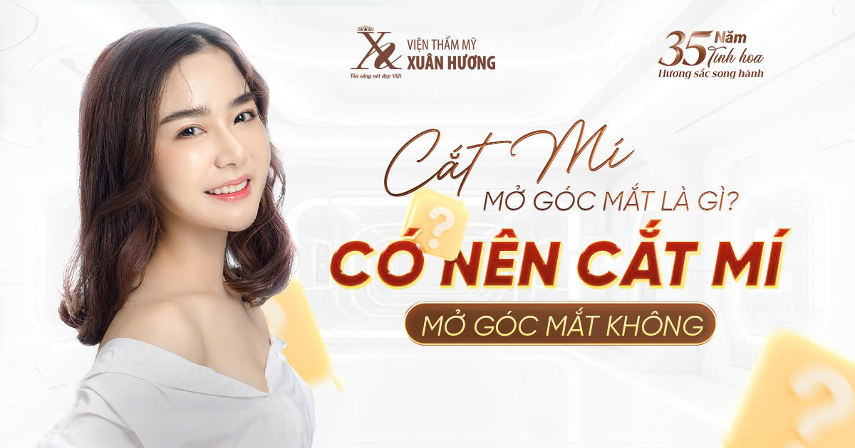 cắt mí mở góc mắt