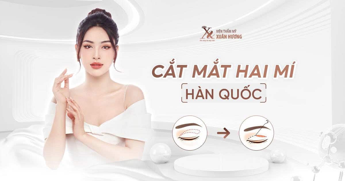 Cắt mắt hai mí Hàn Quốc
