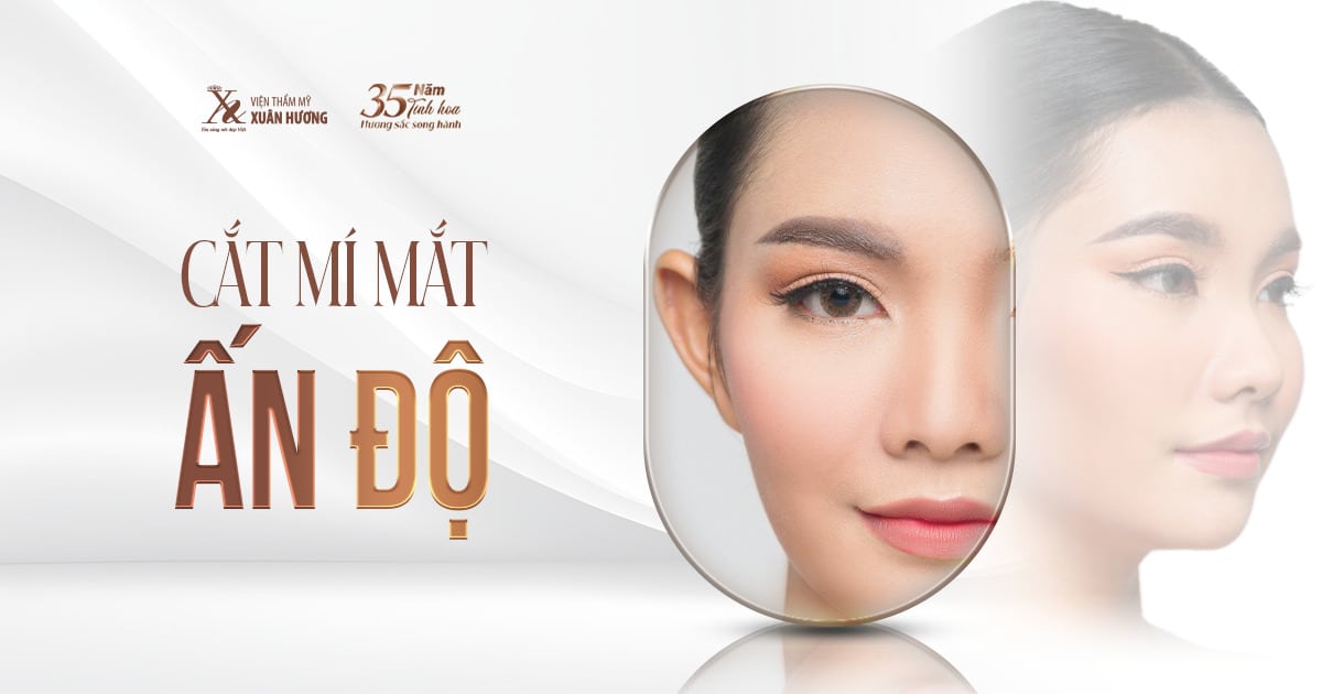 Cắt mí mắt Ấn Độ