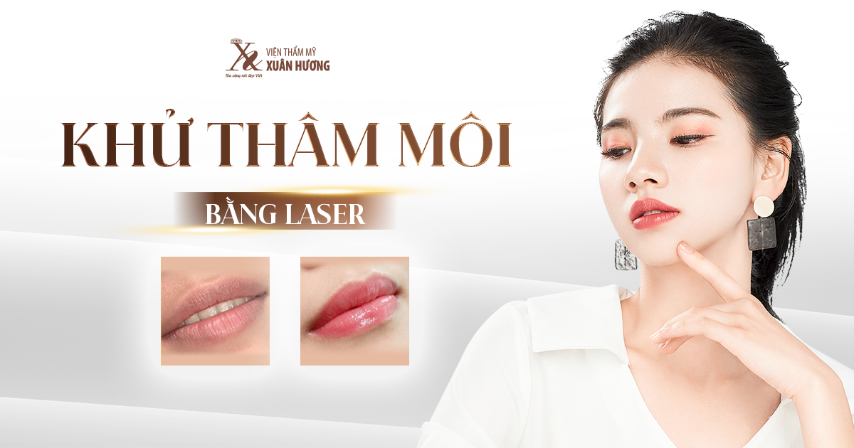 Khử Thâm Môi Bằng Laser