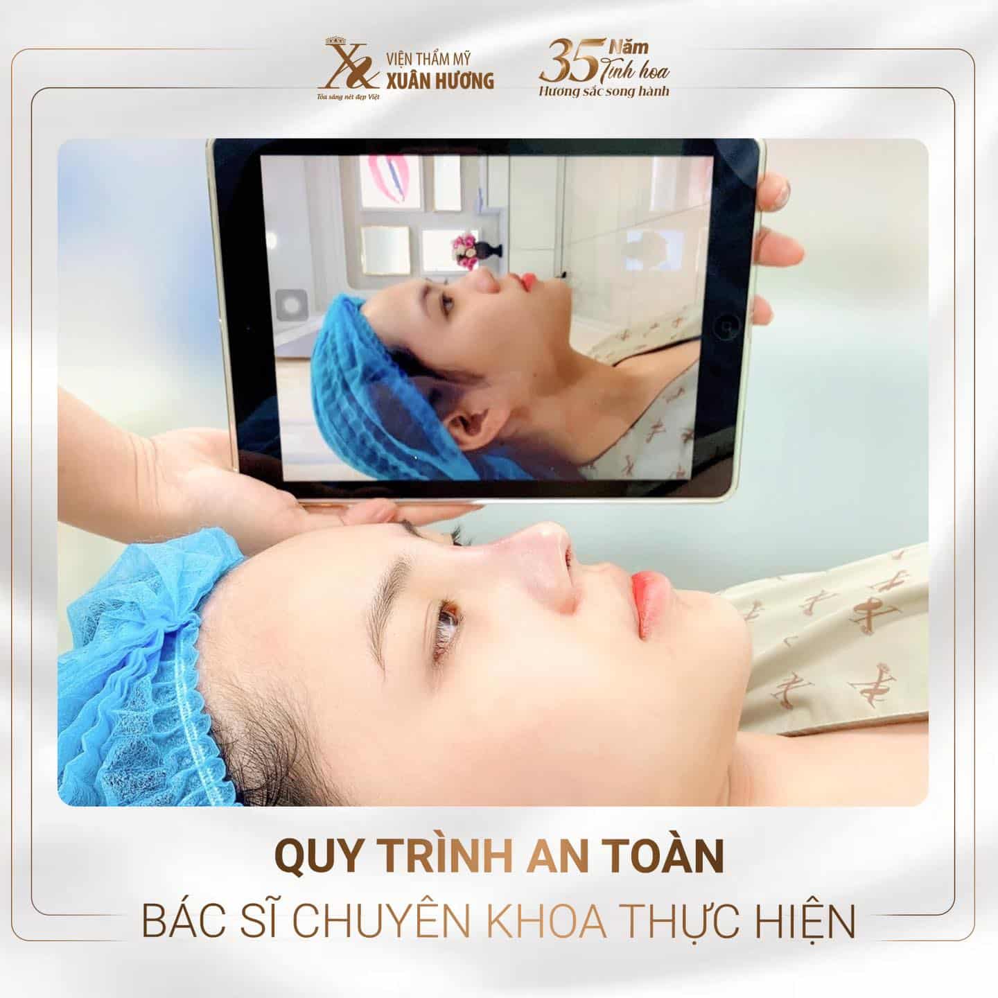 nâng mũi Ergonomic đẹp tự nhiên