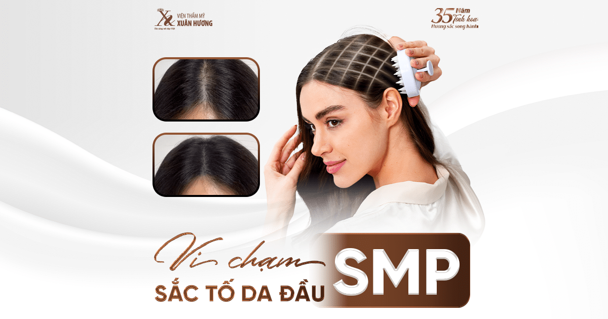 Vi Chạm Sắc Tố Da Đầu SMP
