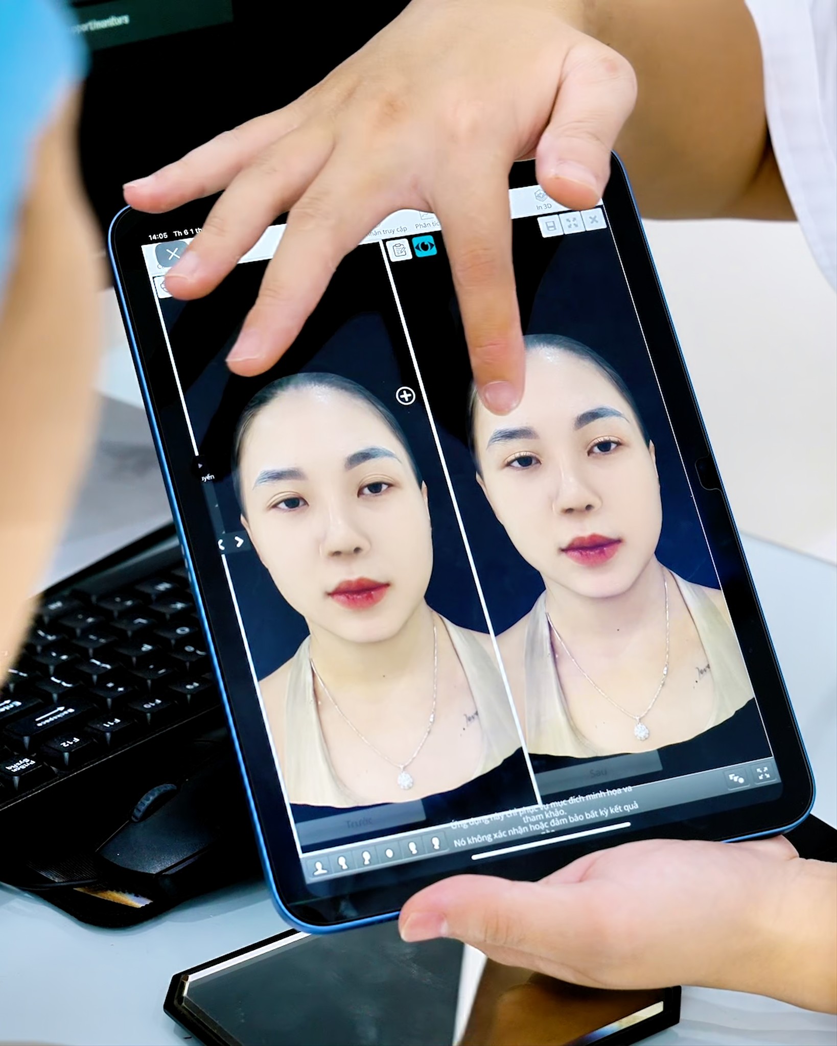 Mô phỏng dáng mí trên gương mặt thật Mô phỏng dáng mí trên gương mặt thật