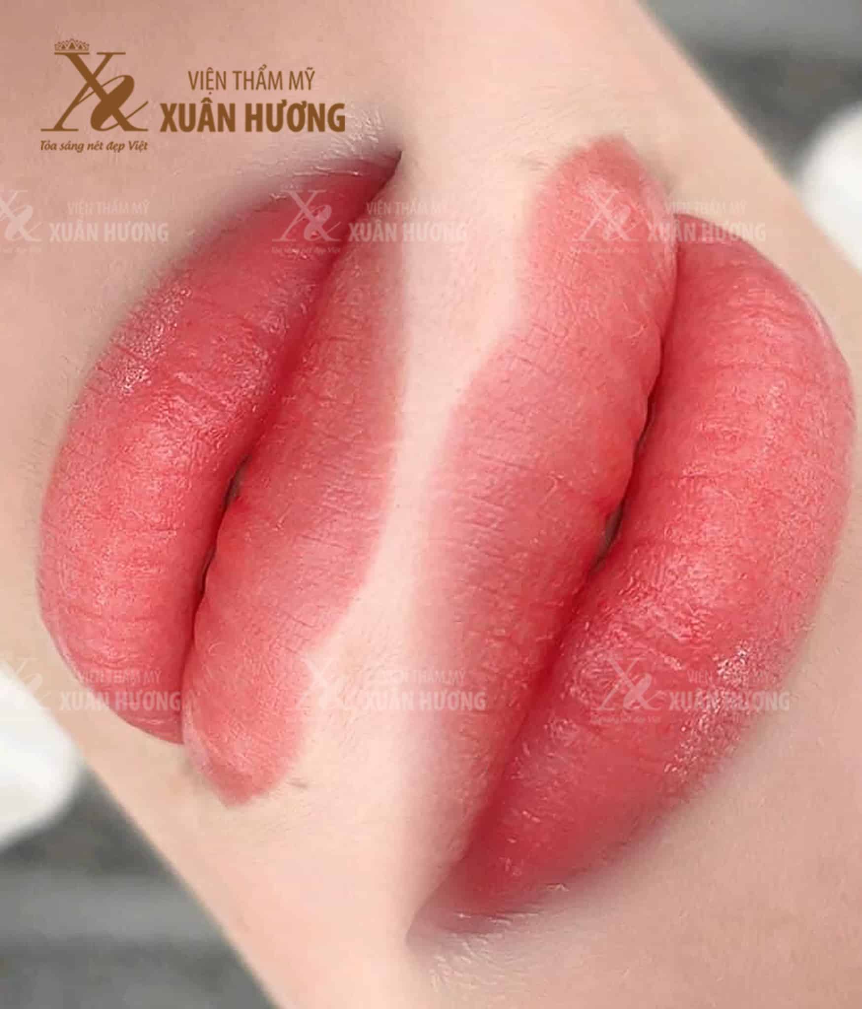 Phun Môi Miracle