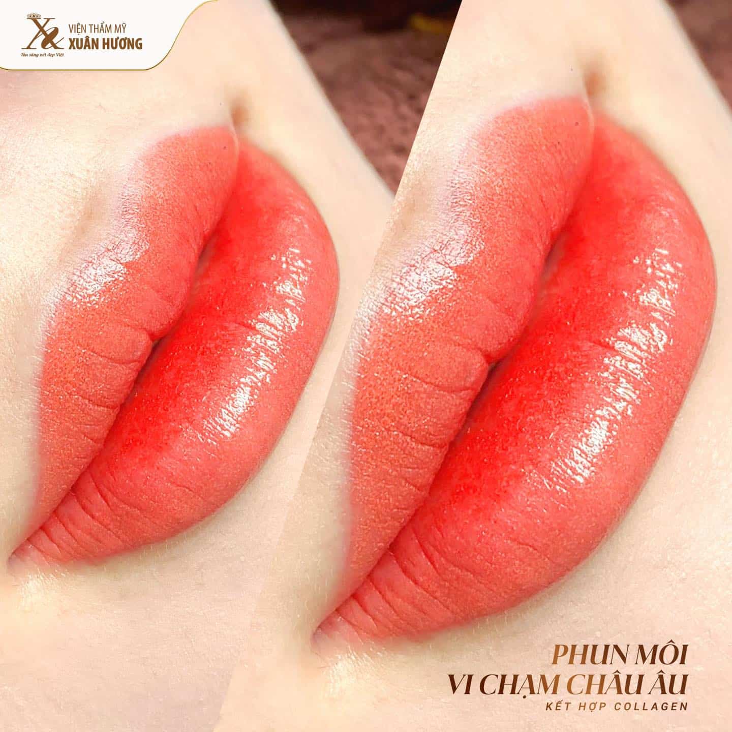 Phun Môi Miracle