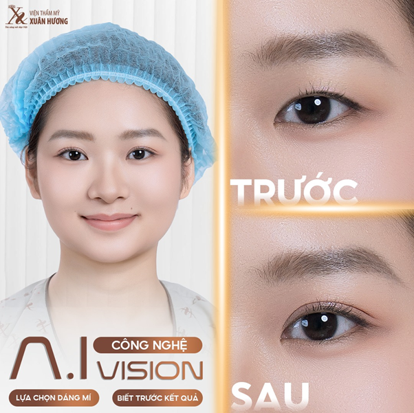 công nghệ cắt mí AI vision