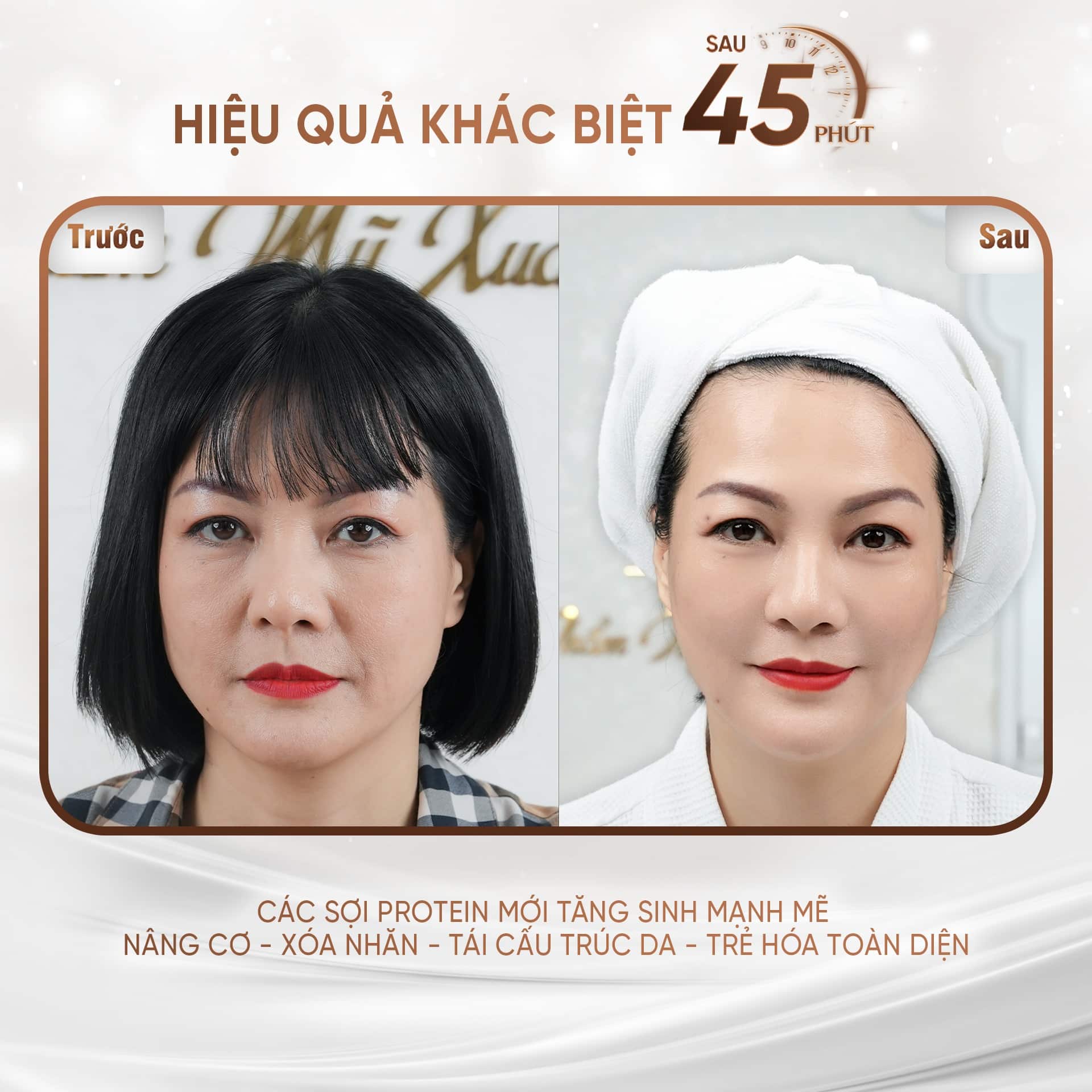 hiệu quả Hifu New Doublo mang lại