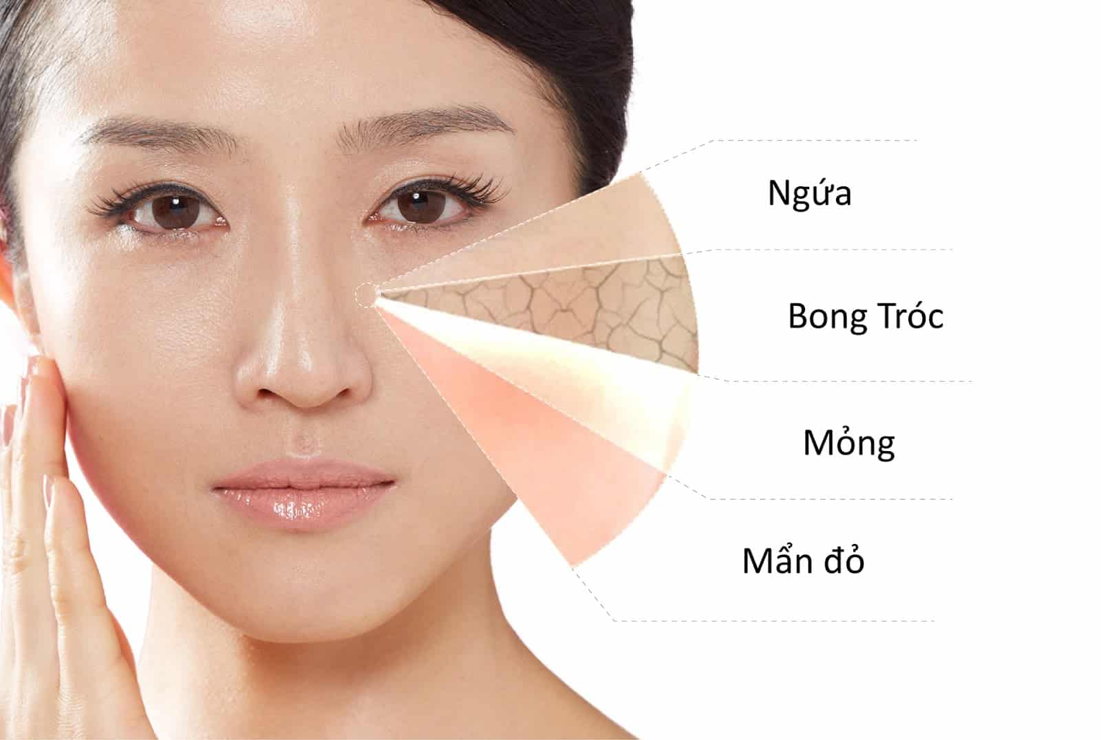 Dấu hiệu cảnh báo da khô