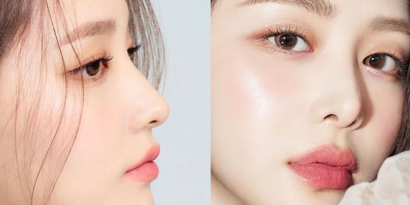 nâng mũi đẹp tại Xuân Hương