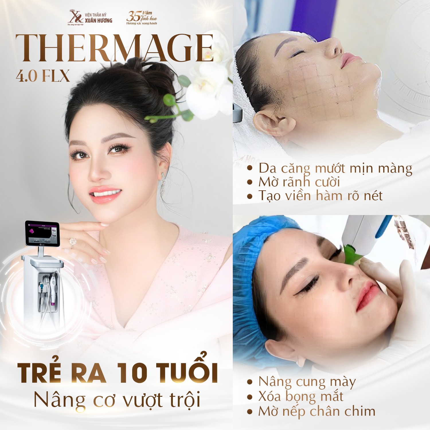 Thermage flx mắt – trẻ hóa ánh nhìn không cần phẫu thuật