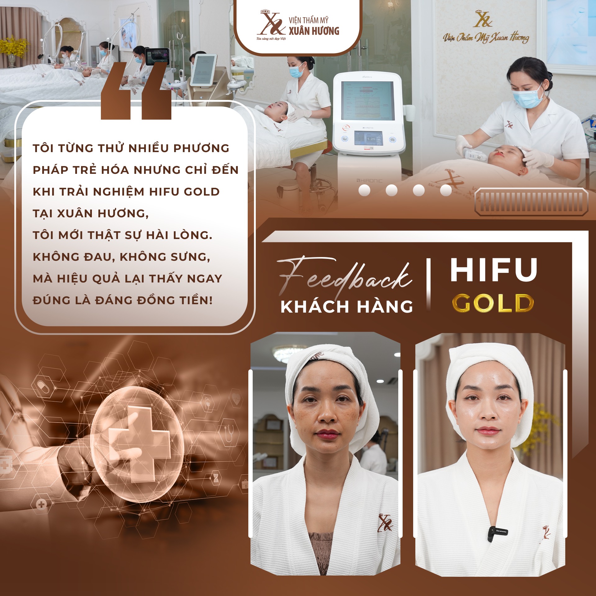 Trẻ hóa da bằng công nghệ Hifu – Giải pháp trẻ hóa da không phẫu thuật