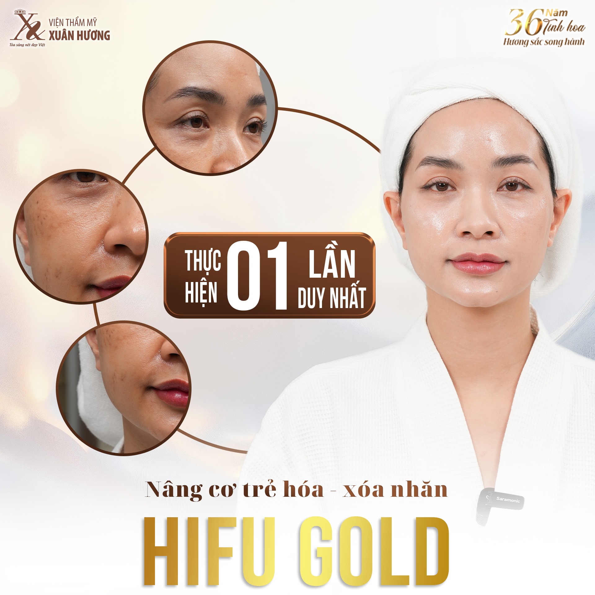 Trẻ hóa xóa nhăn với công nghệ Hifu chỉ sau 1 lần thực hiện