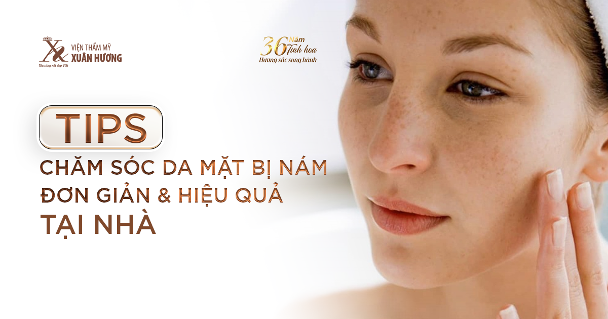 Tips chăm sóc da mặt bị nám đơn giản và hiệu quả tại nhà