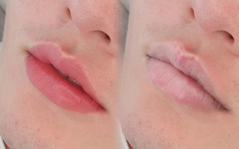 phun môi khử thâm cho nam giới