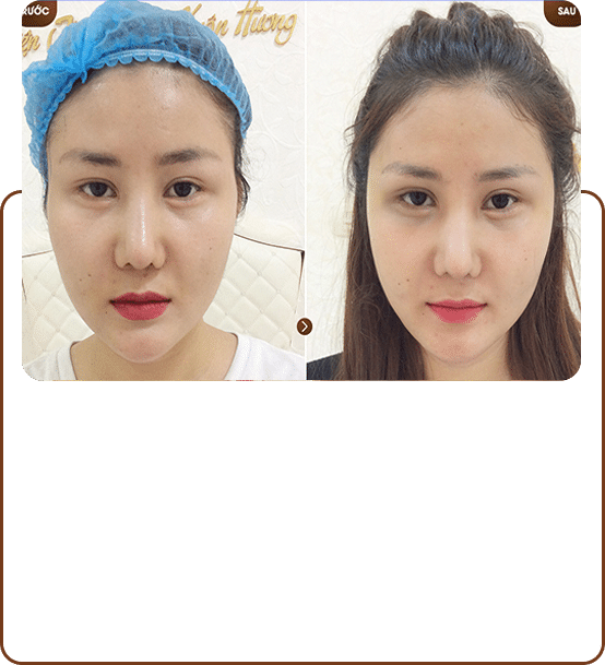 Phẫu thuật thẩm mỹ