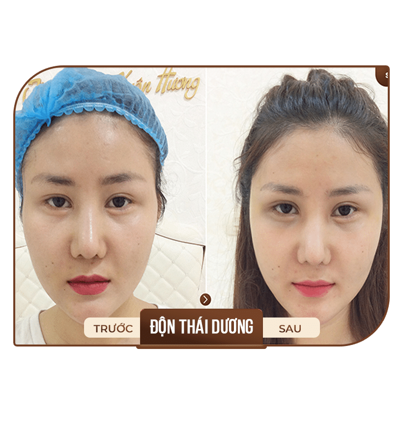 Phẫu thuật thẩm mỹ