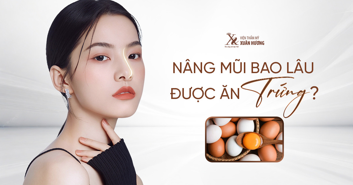 Nâng mũi bao lâu được ăn trứng