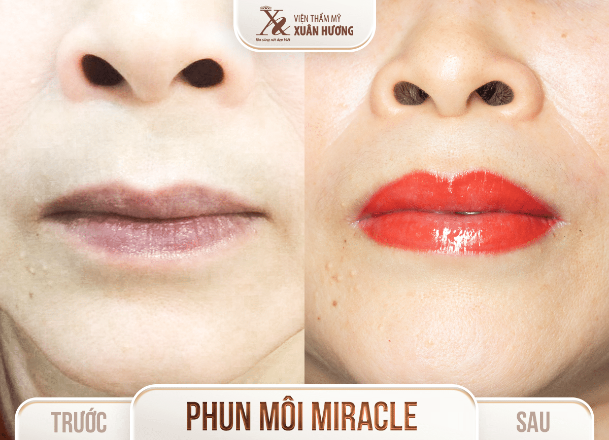 Ảnh trước sau – Phun xăm thẩm mỹ