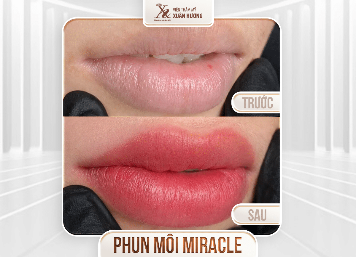 Ảnh trước sau – Phun xăm thẩm mỹ