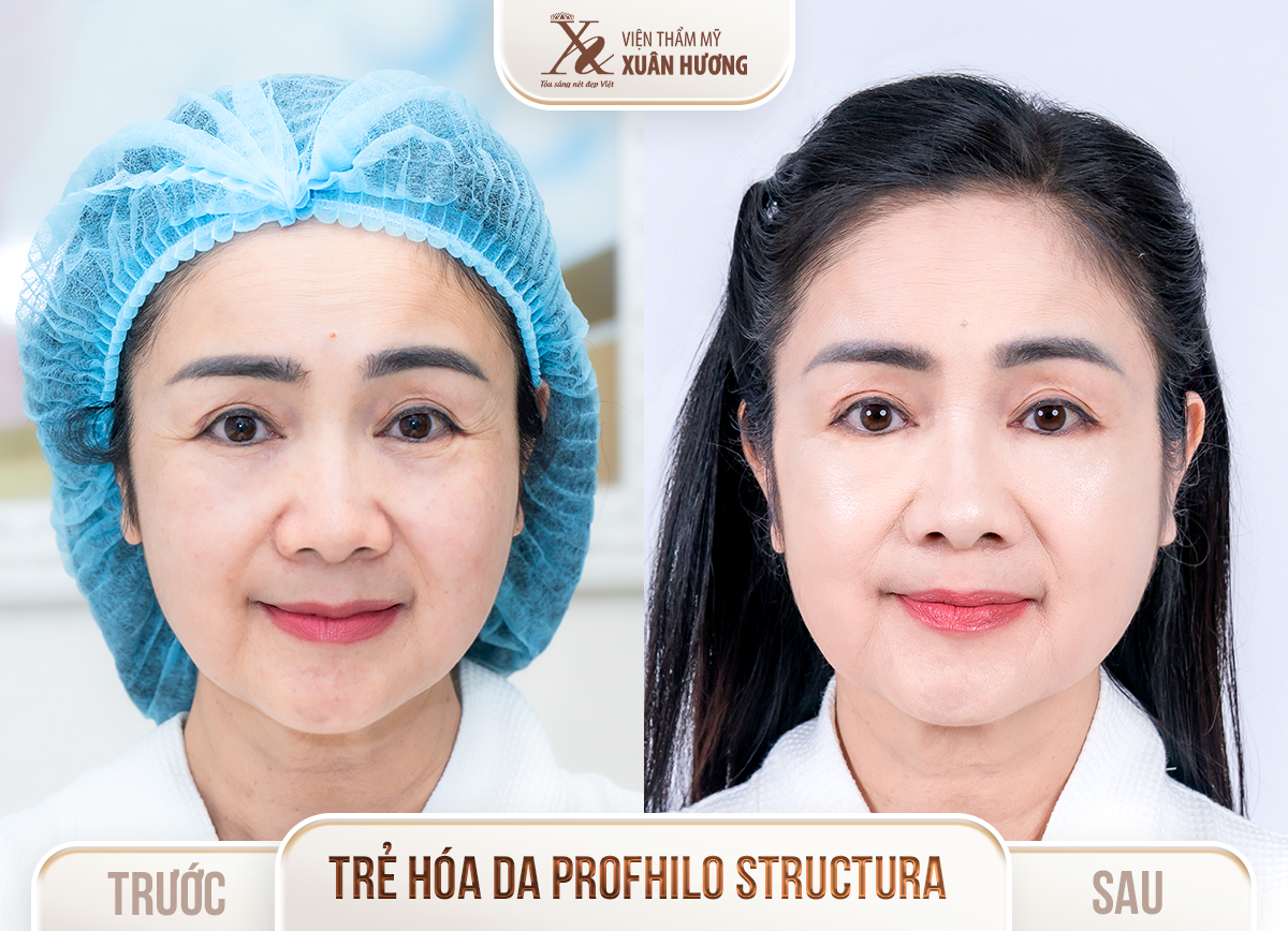 Ảnh trước sau – Thẩm mỹ công nghệ cao