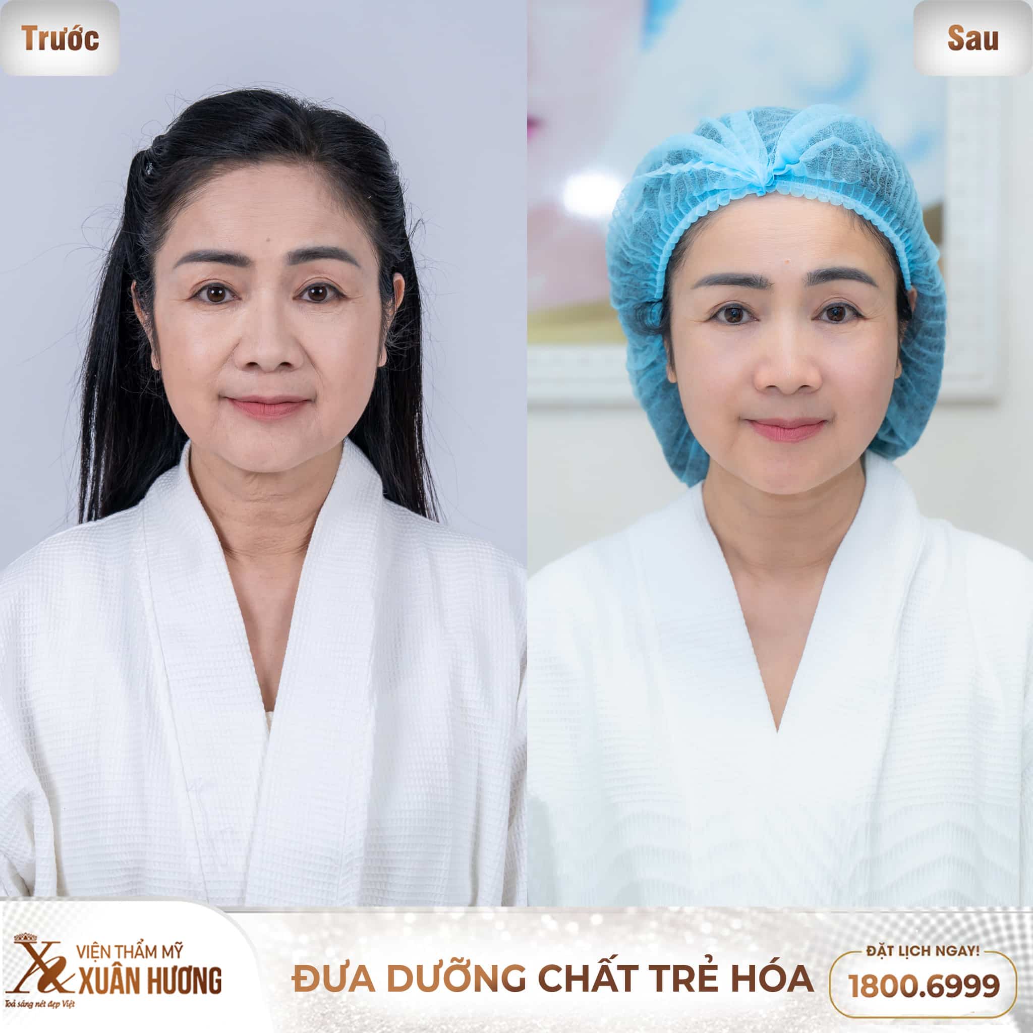 NSND Thu Hà trẻ háo da tại Viện Thẩm Mỹ Xuân Hương