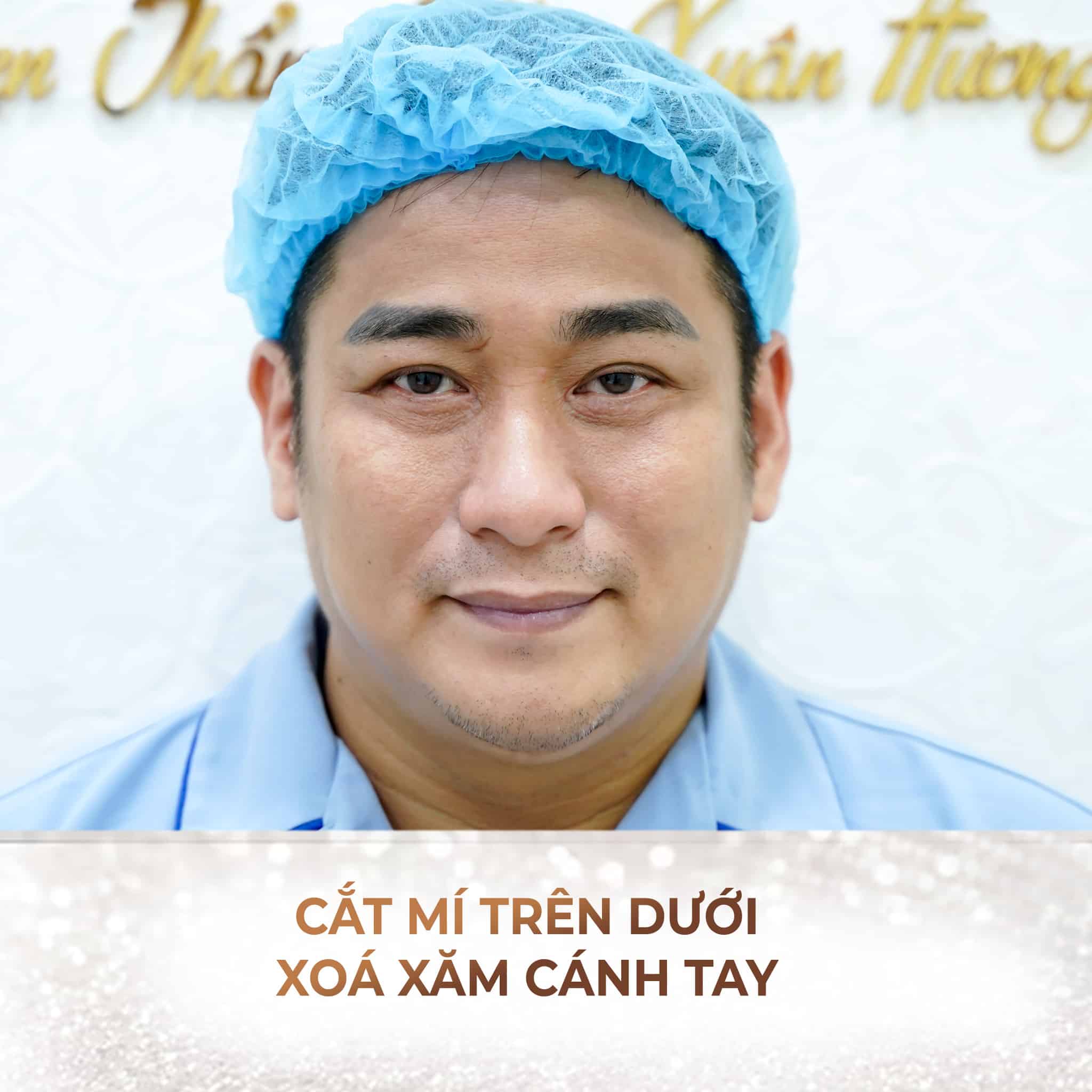 diễn viên minh tiệp làm đẹp tại Xuân Hương