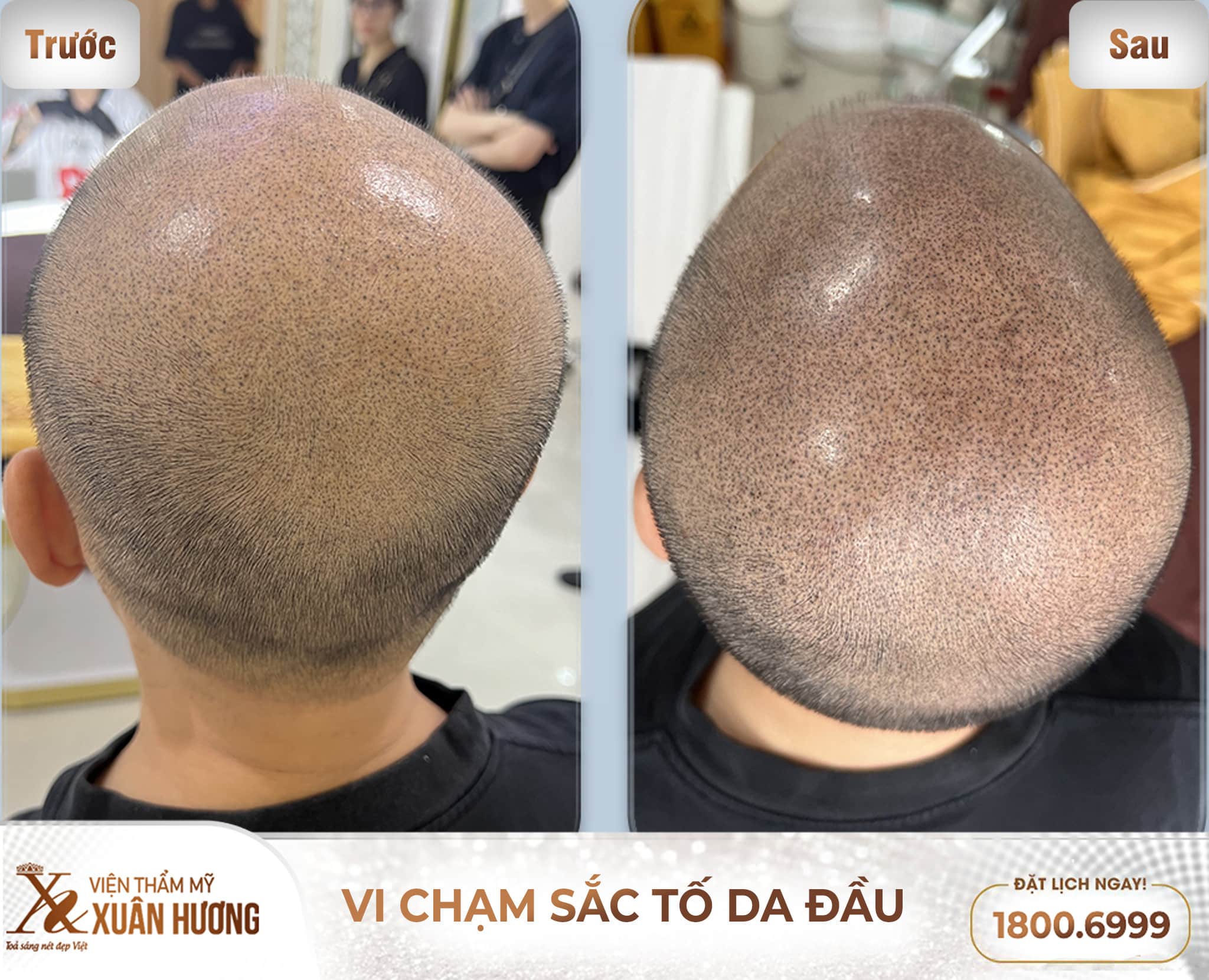 doanh nhân dương quốc nam vi chạm sắc tốc da đầu