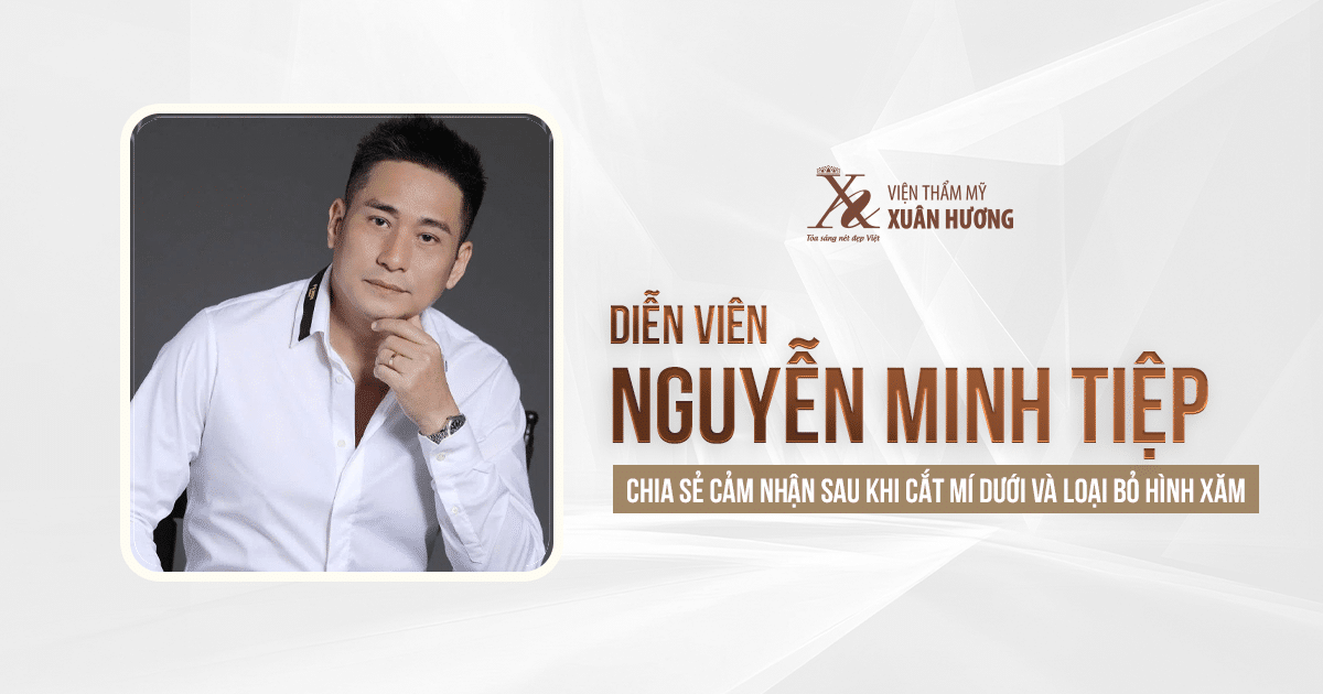Diễn Viên Minh Tiệp Chia Sẻ Cảm Nhận Sau Khi Cắt Mí Dưới Và Loại Bỏ Hình Xăm